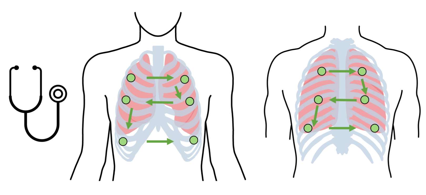 SputumLocator: Enhancing Airway Clearance with Auscultation-based Sputum Localization
